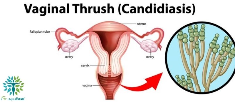 Candida Mantarı