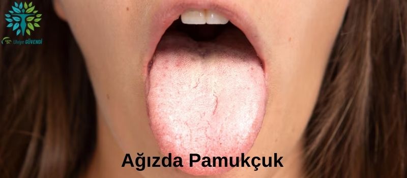 Kandida Mantarı