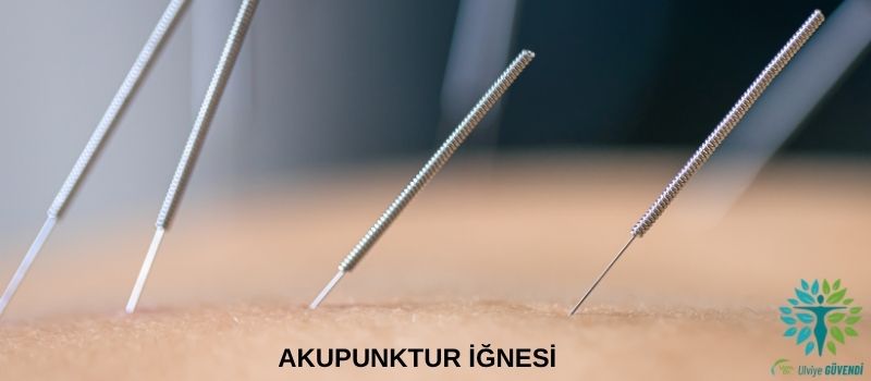 Akupunktur İğnesi Nedir? Uygulama Şekli, Etkileri