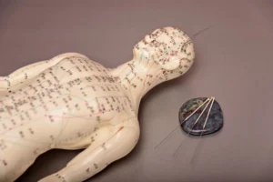 Akupunktur noktaları vücut haritası üzerinde işaretlenmiş meridyen sistemi ve uygulama iğneleri