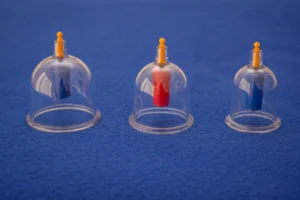 Hacamat günleri 2026 için bilgilendirici içerikte kullanılan hacamat kupaları