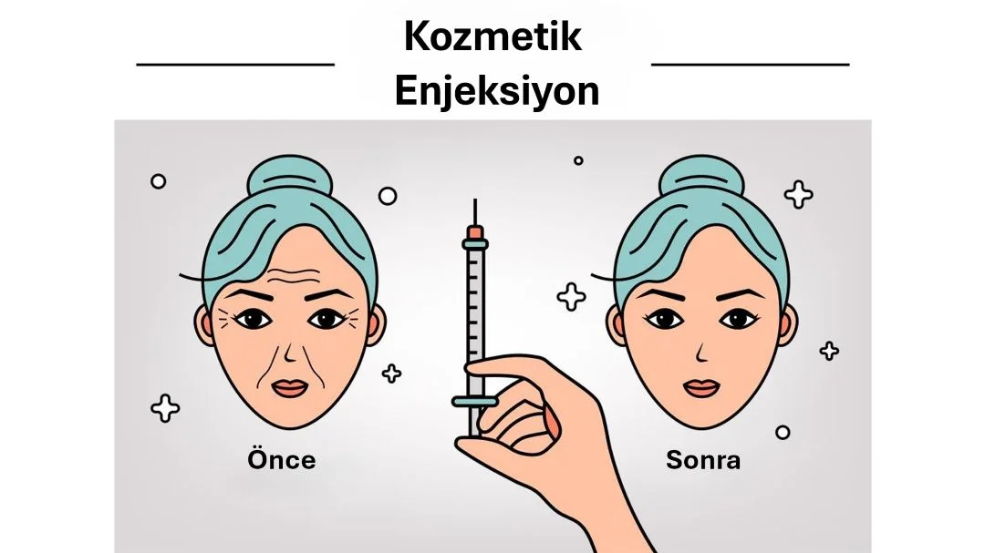 mezoterapi öncesi ve sonrası cilt görünümünü gösteren kozmetik enjeksiyon uygulaması illüstrasyonu