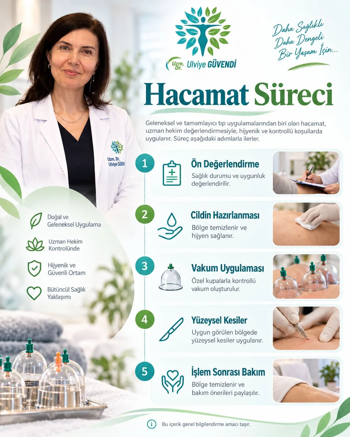 Hacamat nasıl yapılır? Ön değerlendirme, cildin hazırlanması, vakum uygulaması, yüzeysel kesiler ve işlem sonrası bakım aşamalarını gösteren infografik.
